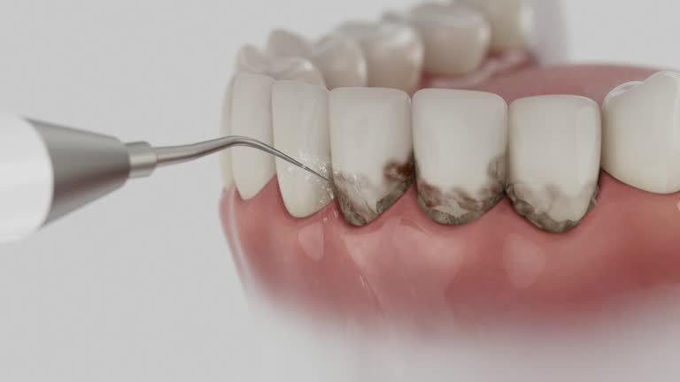 Trusted Wisdom Tooth Removal service in Coalfield, TN - Dentist Open Now